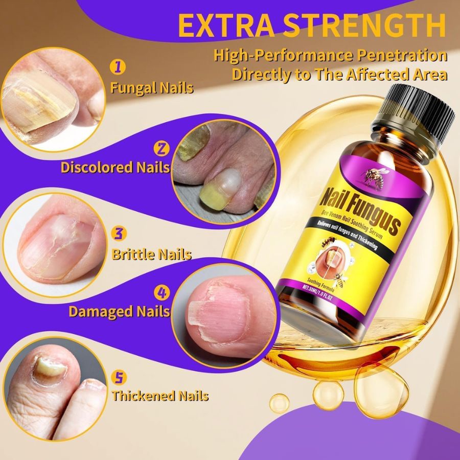 Fungi Free - Bee Venom Fungus Treatment